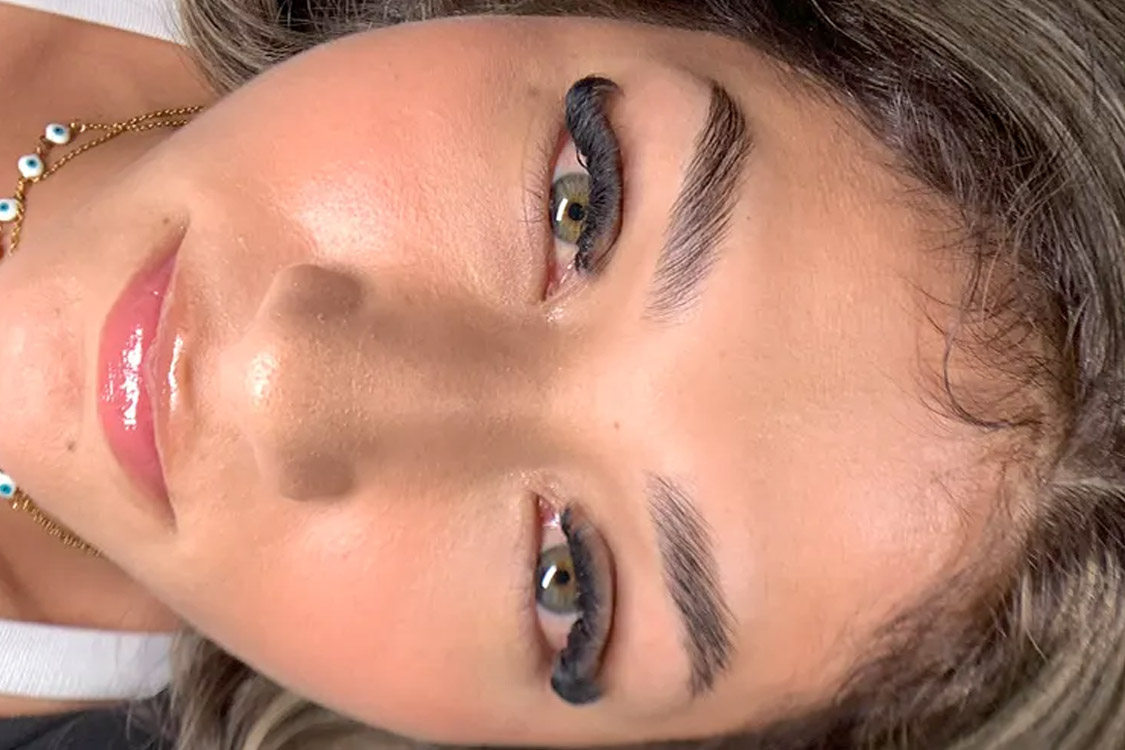 Borrado de cejas con láser