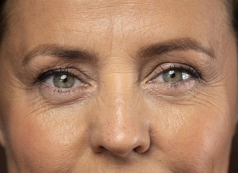 Borrado de delineado con láser