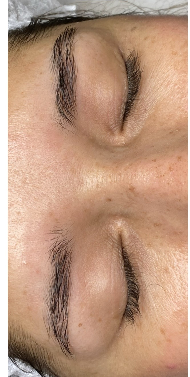 Caso de éxito Método Brath cejas