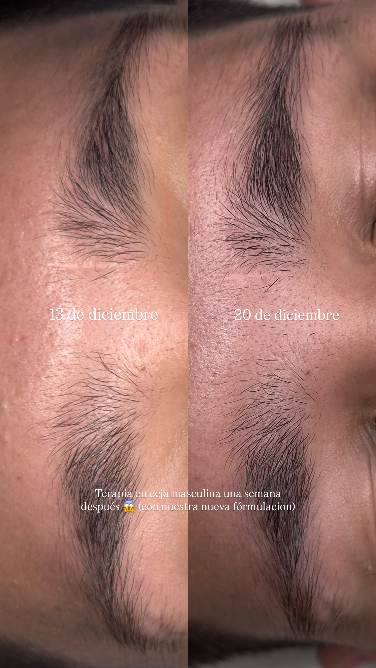 Caso de éxito Método Brath cejas