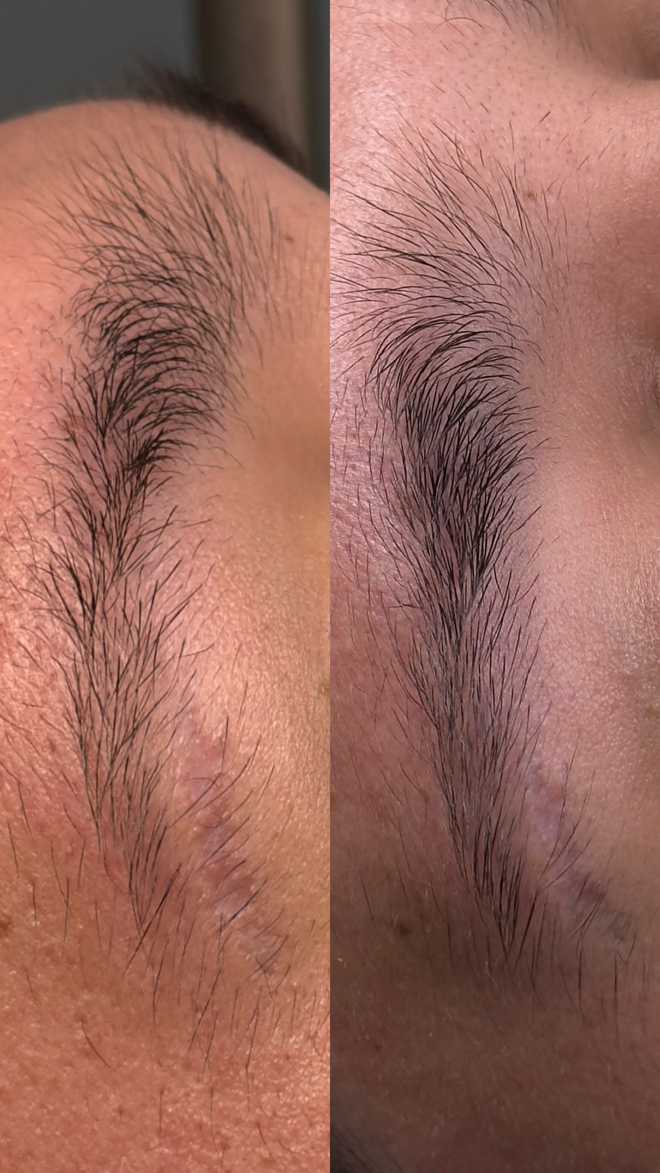 Caso de éxito Método Brath cejas