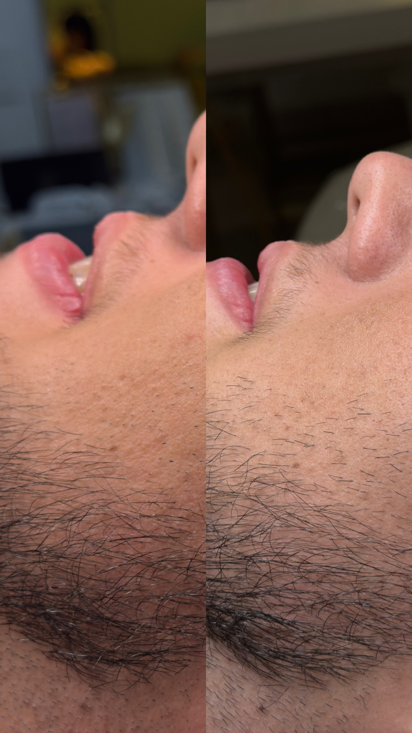 Método Brath barba - Dani Osorio Studio