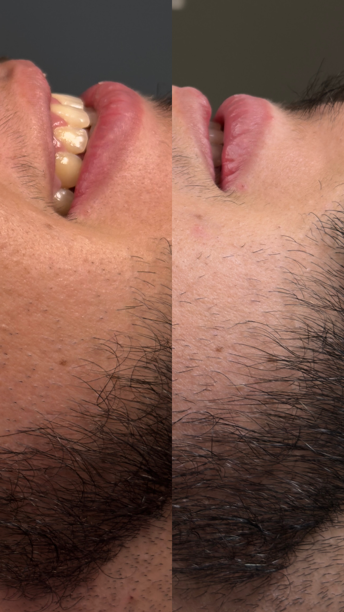 Método Brath barba - Dani Osorio Studio