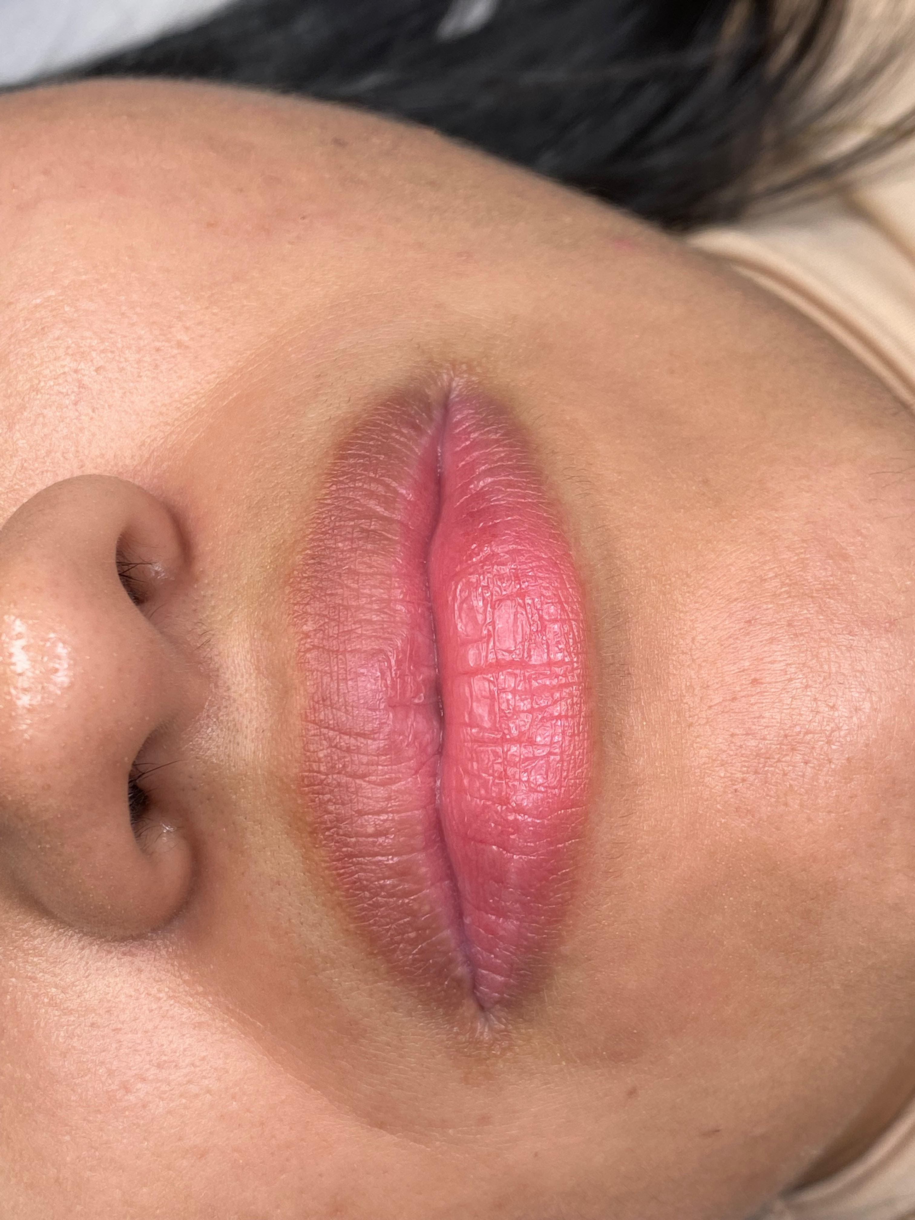Hidra Lips 3