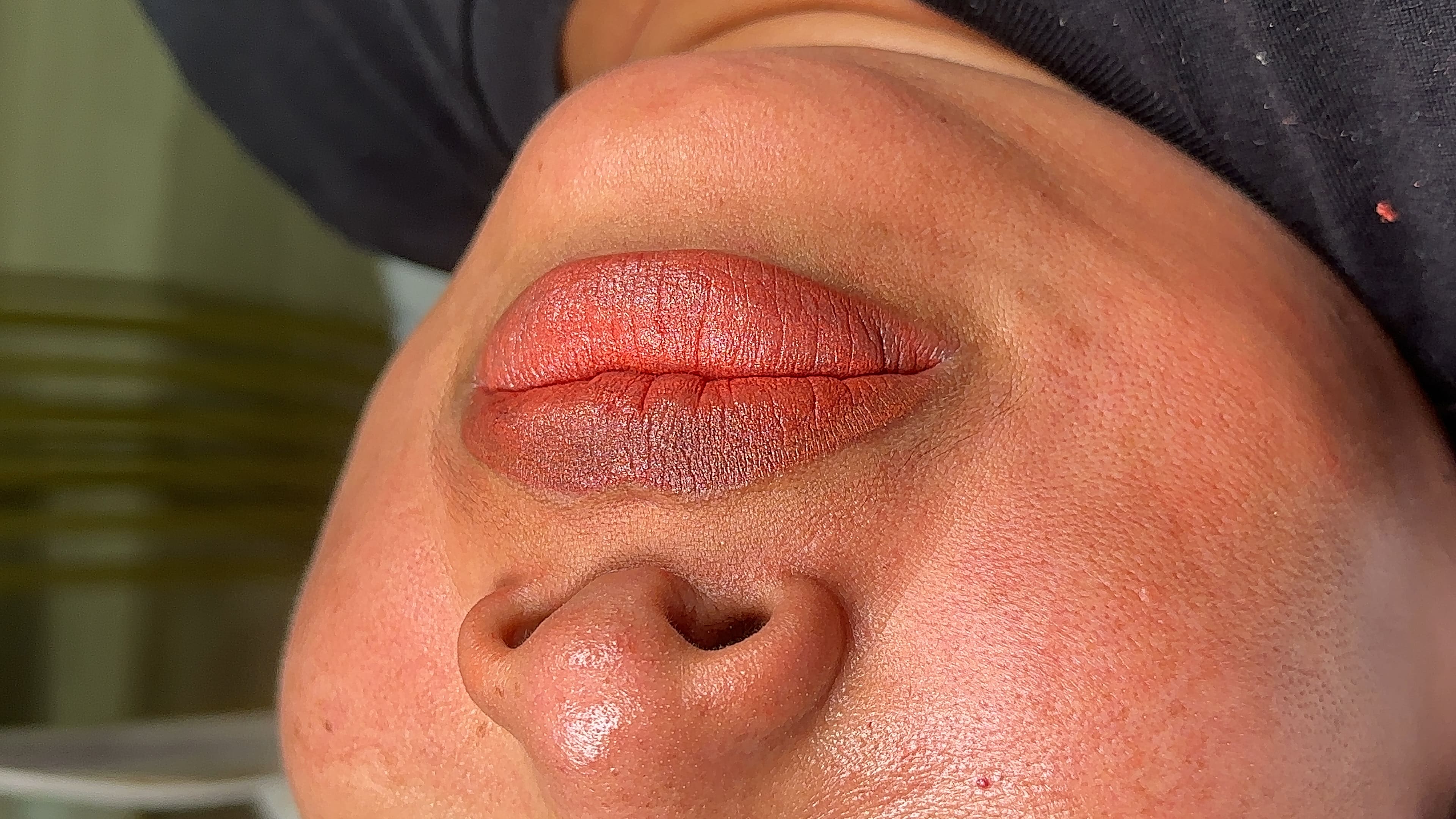 Neutralización labios 10