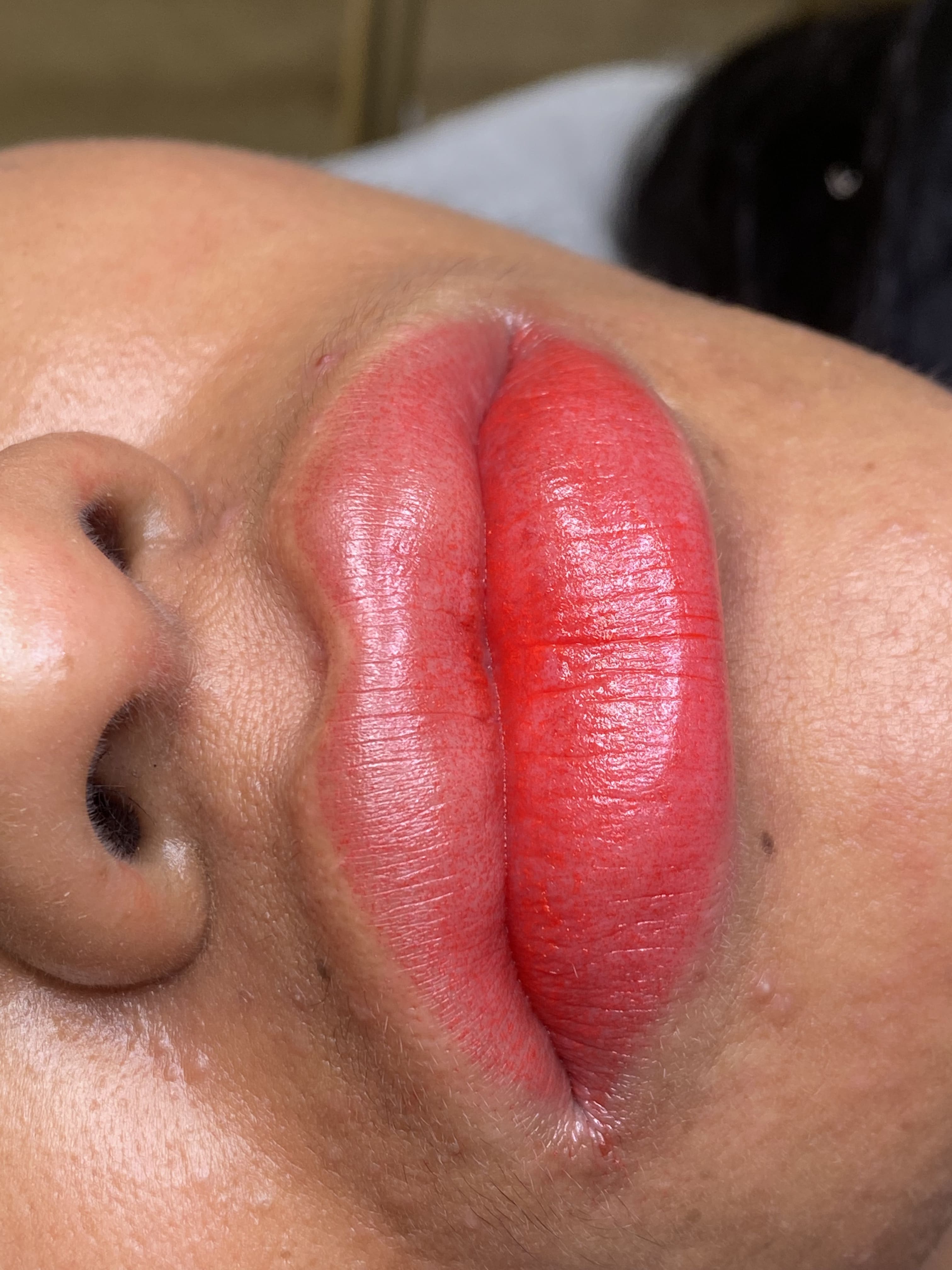 Neutralización labios 5