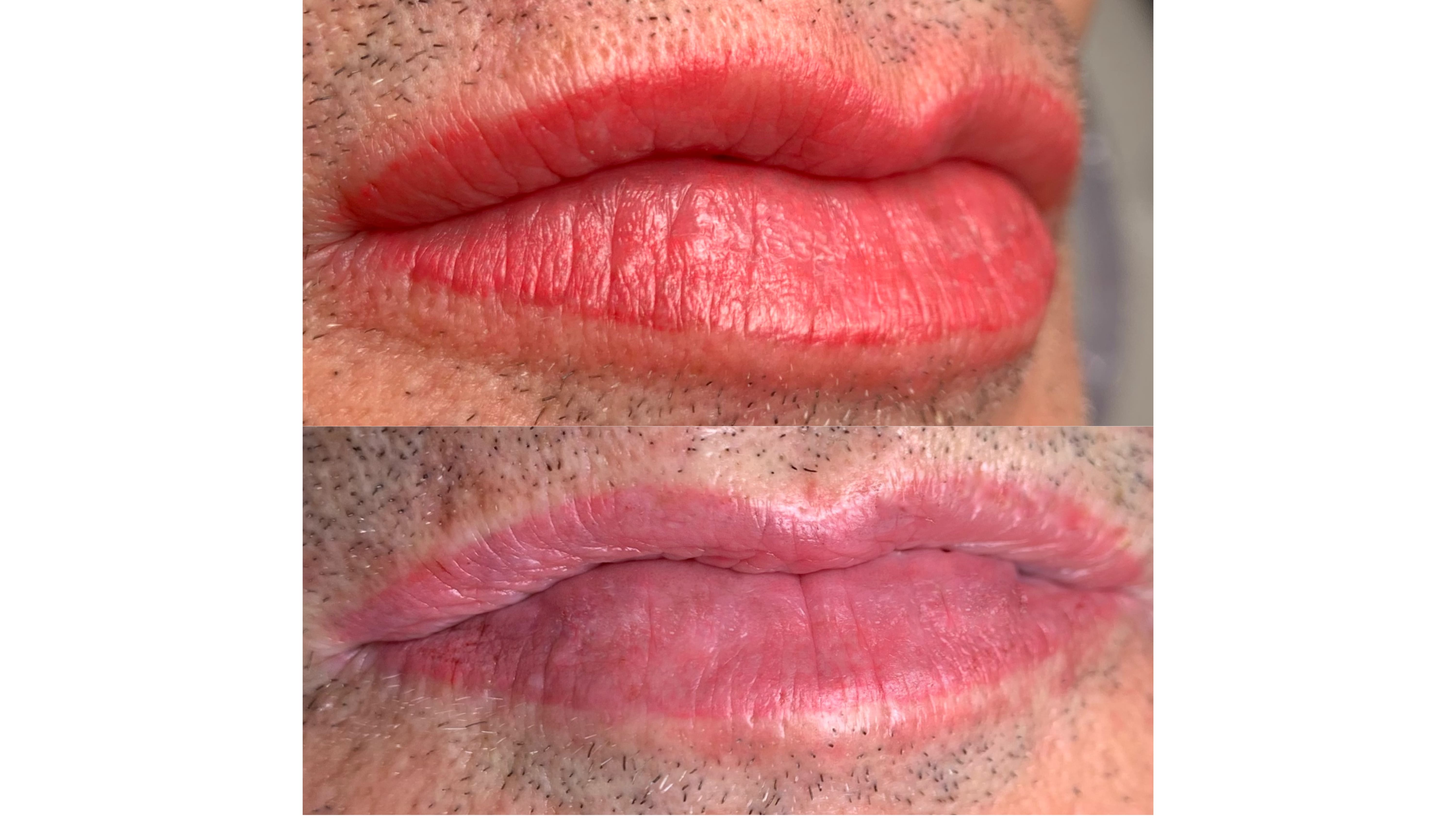 Remoción química cejas y labios - Dani Osorio Studio