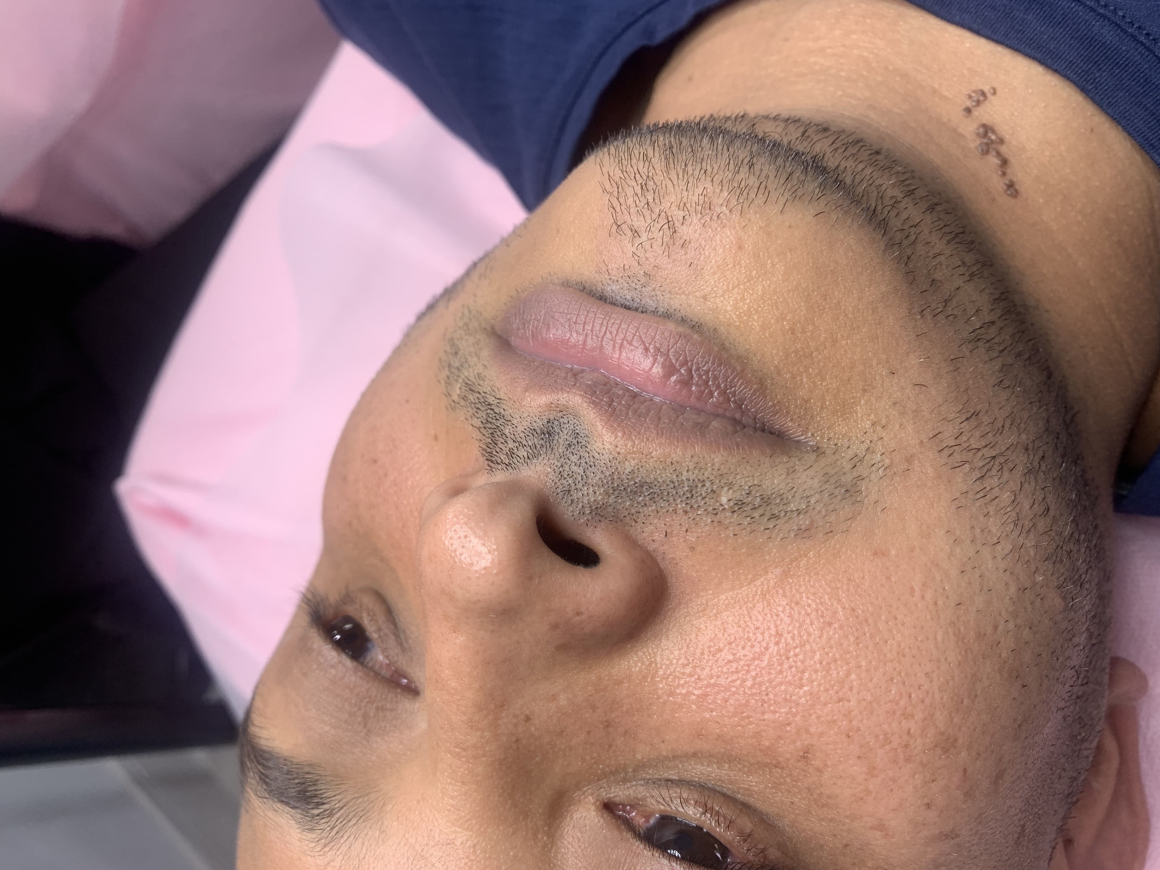 Revitalización labios masculinos 7